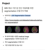 Un estudio sobre la automatización del diagnóstico de cáncer basado en imágenes de resonancia magnética